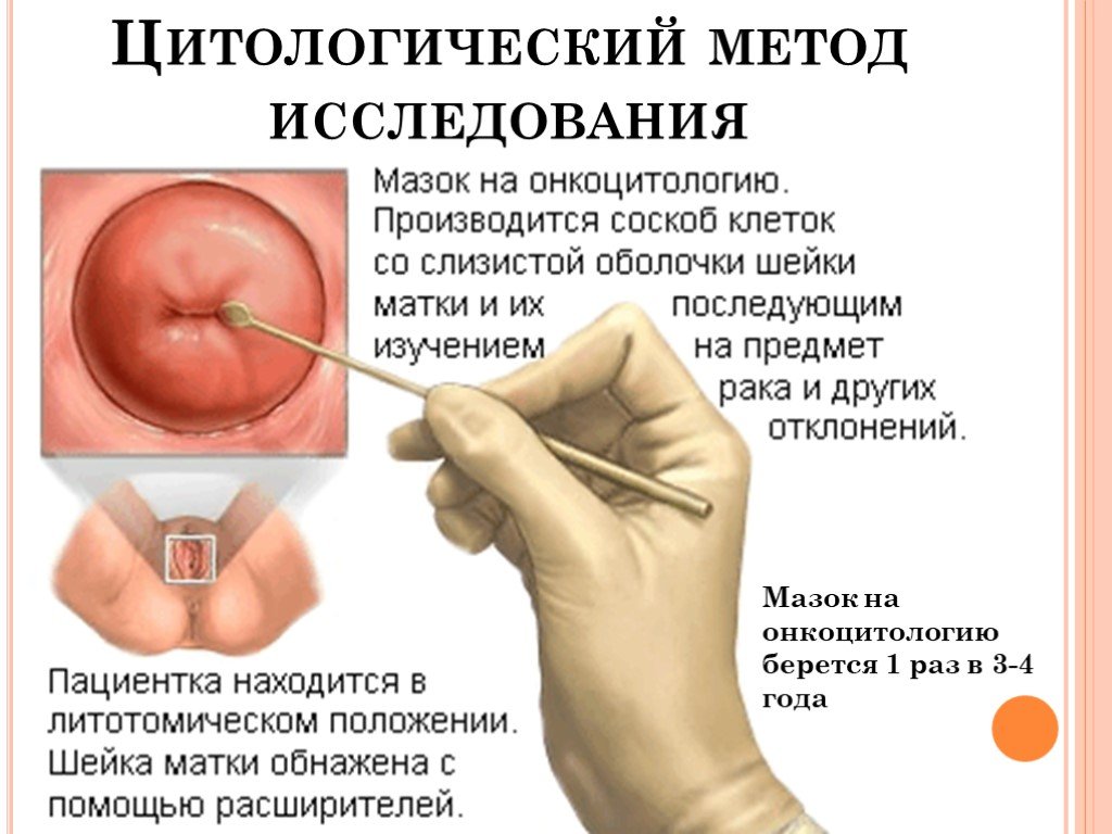 Методы гистологии и цитологии: в чем разница проведения исследований, подготовка | клиники «евроонко»